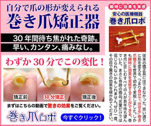 巻き爪ロボの口コミ