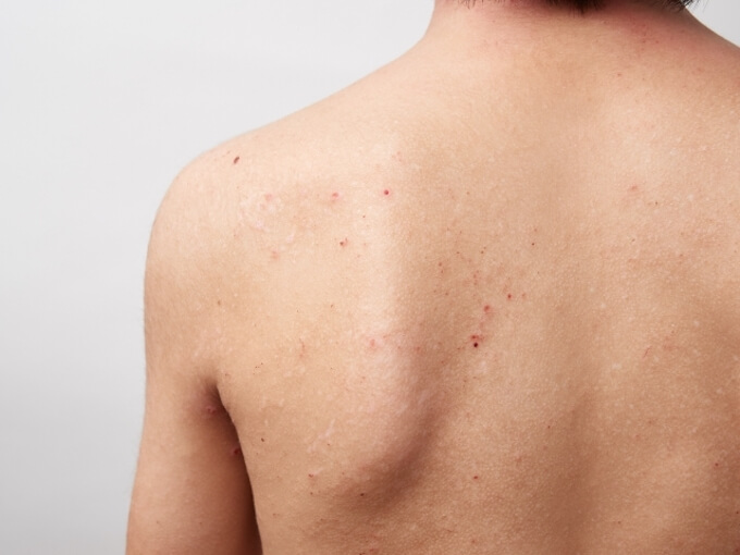 医師の診察を受ける時期