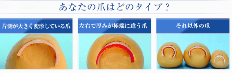 巻き爪ロボ